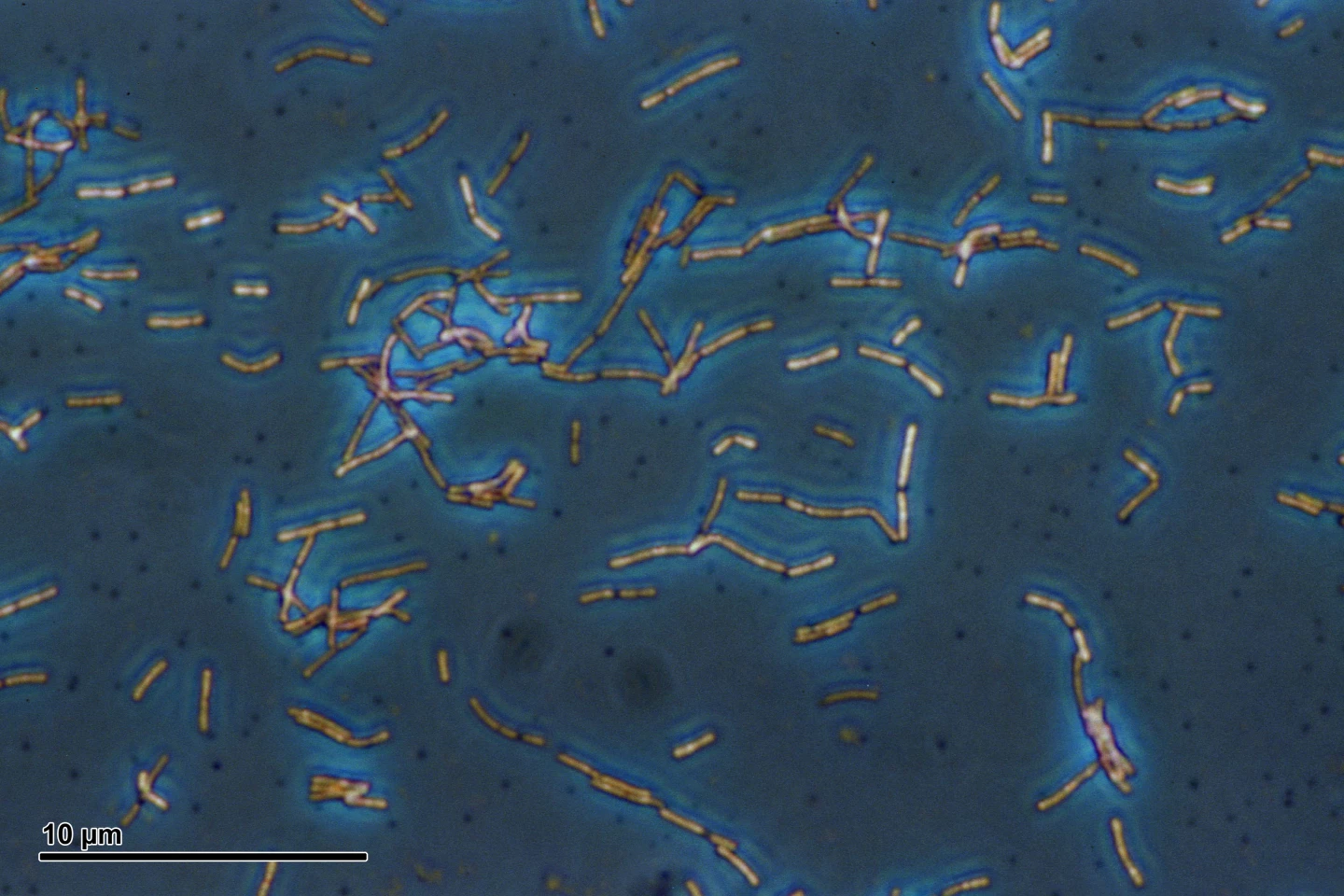 Bakterie Lactobacillus acidophilus
